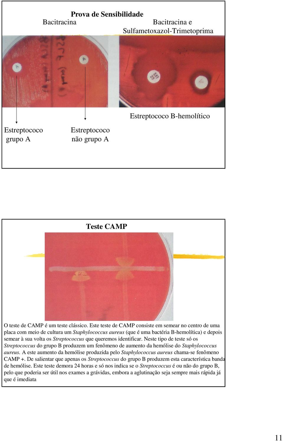 identificar. Neste tipo de teste só os Streptococcus do grupo B produzem um fenômeno de aumento da hemólise do Staphylococcus aureus.