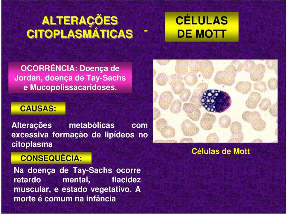 CAUSAS: Alterações metabólicas com excessiva formação de lipídeos no citoplasma