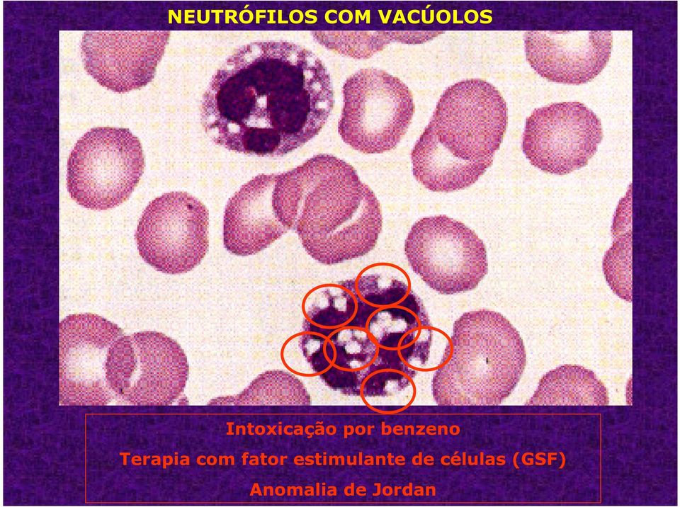 Terapia com fator