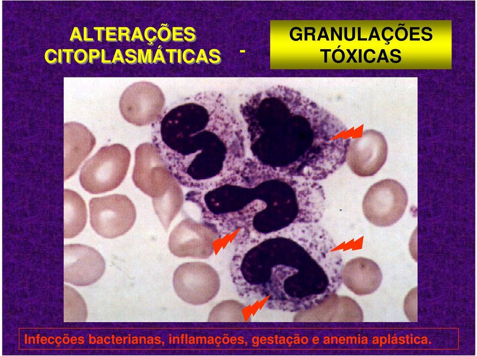 Infecções bacterianas,