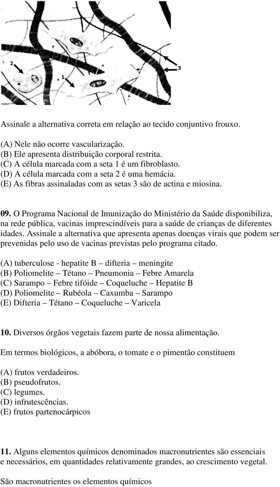 O Programa Nacional de Imunização do Ministério da Saúde disponibiliza, na rede pública, vacinas imprescindíveis para a saúde de crianças de diferentes idades.