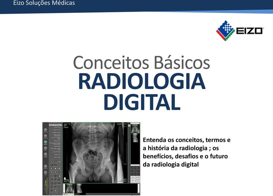 termos e a história da radiologia ; os