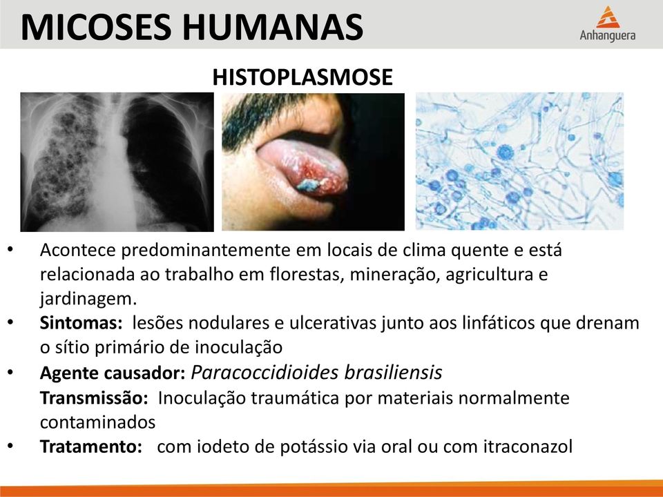 Sintomas: lesões nodulares e ulcerativas junto aos linfáticos que drenam o sítio primário de inoculação