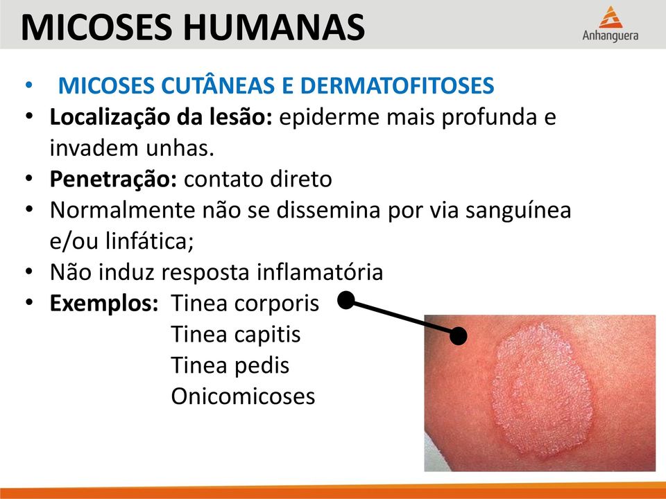 Penetração: contato direto Normalmente não se dissemina por via