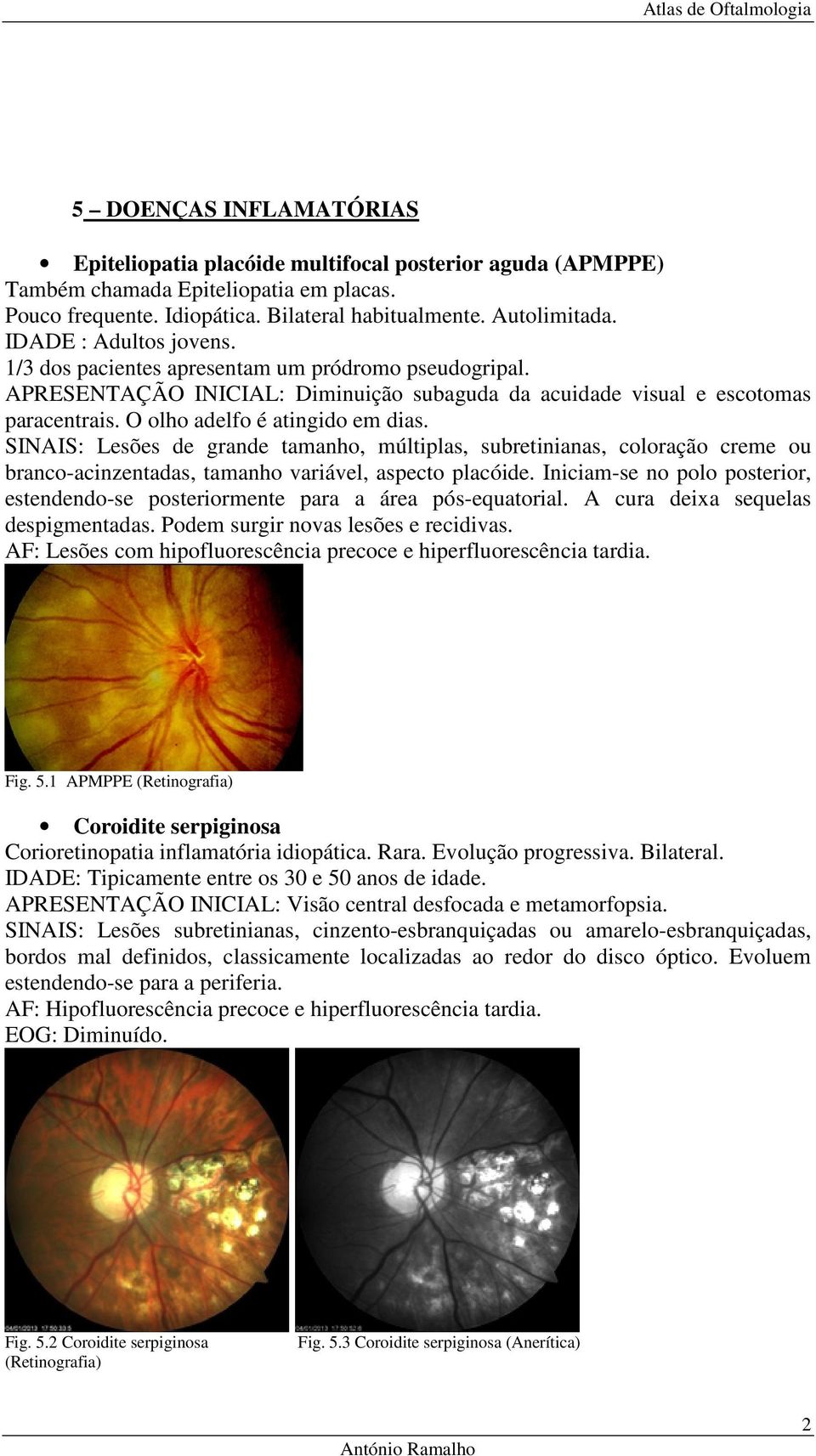 SINAIS: Lesões de grande tamanho, múltiplas, subretinianas, coloração creme ou branco-acinzentadas, tamanho variável, aspecto placóide.