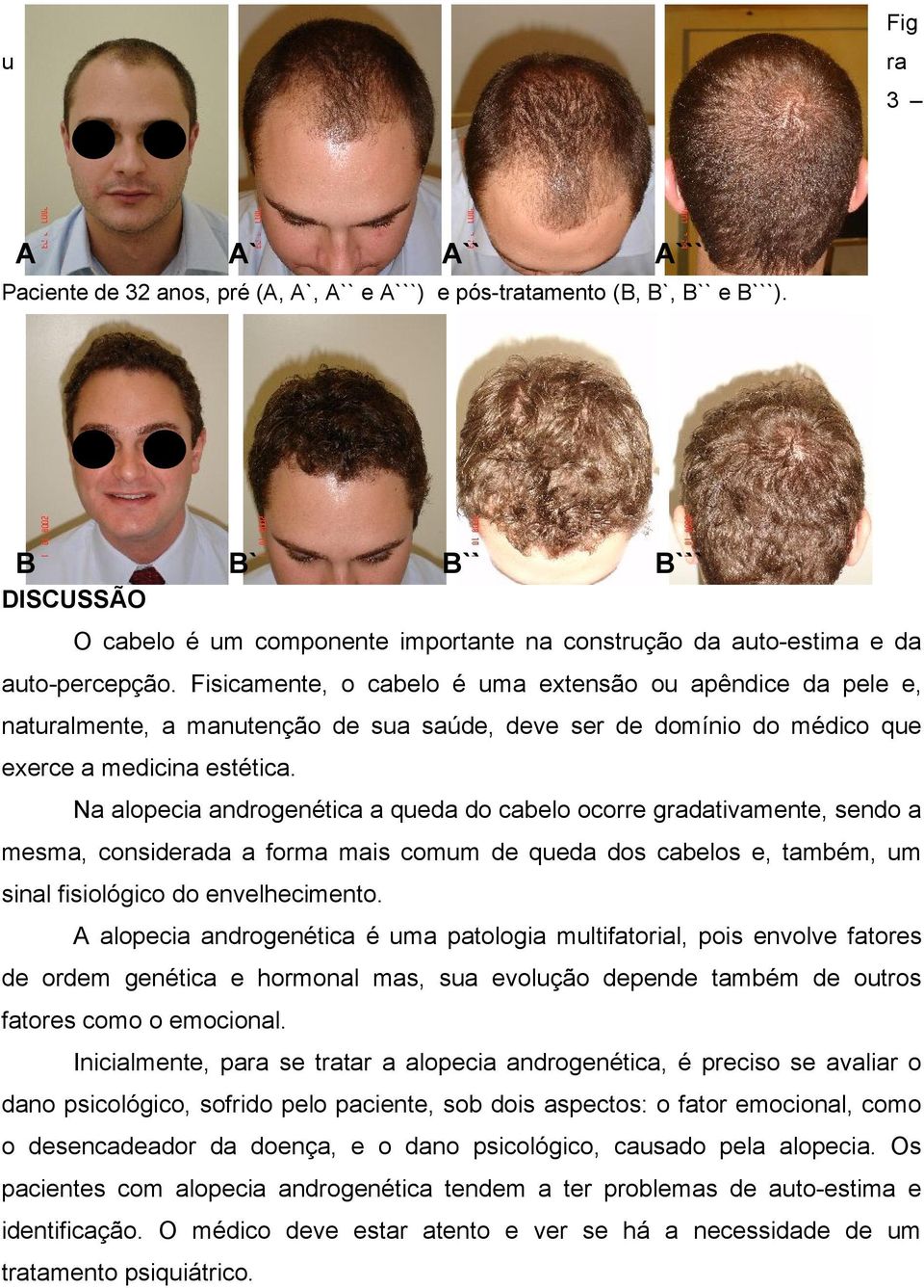 Fisicamente, o cabelo é uma extensão ou apêndice da pele e, naturalmente, a manutenção de sua saúde, deve ser de domínio do médico que exerce a medicina estética.