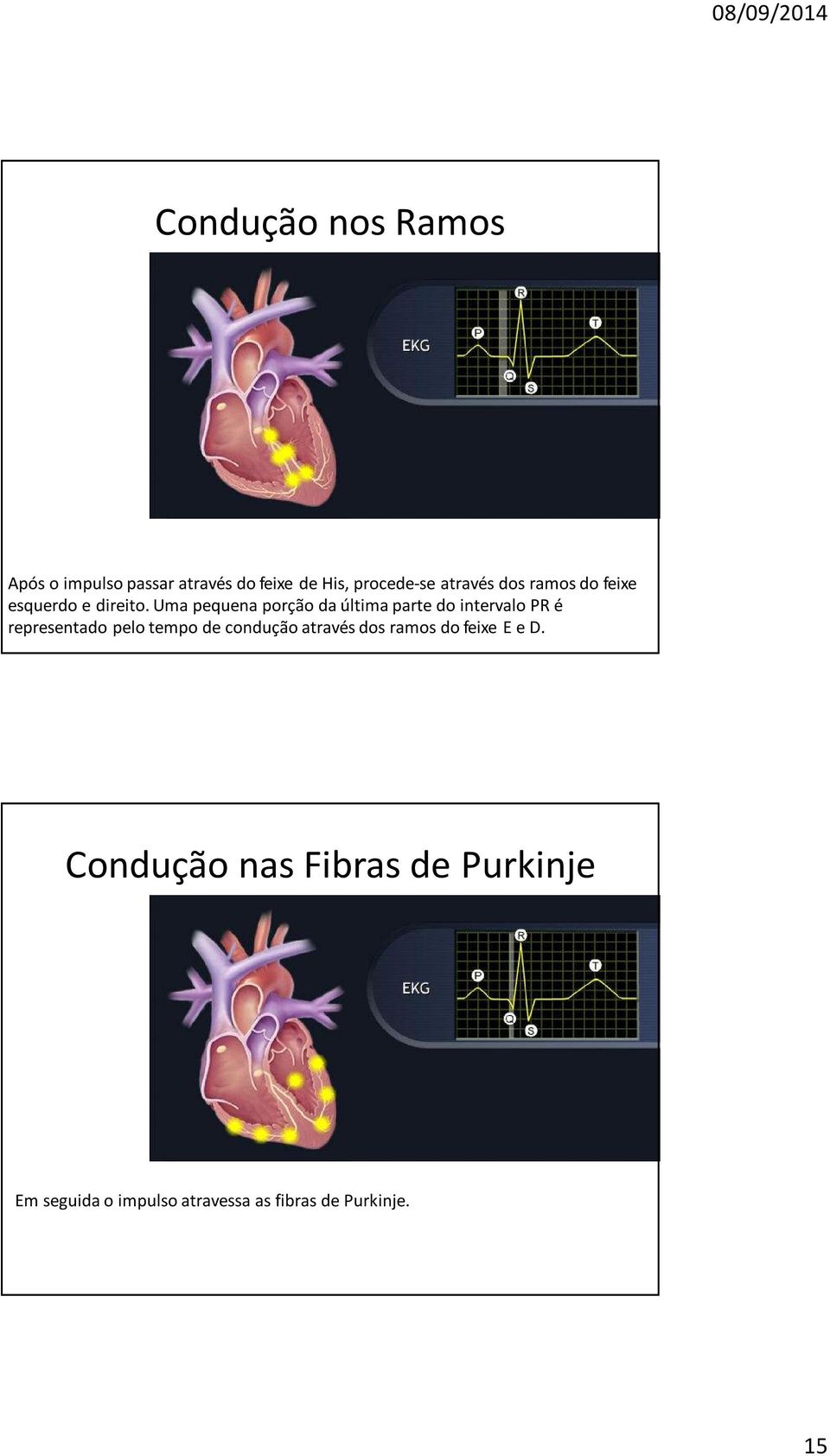 Uma pequena porção da última parte do intervalo PR é representado pelo tempo de