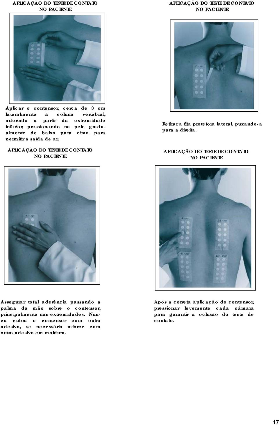 APLICAÇÃO DO TESTE DE CONTATO NO PACIENTE Retirar a fita protetora lateral, puxando-a para a direita.