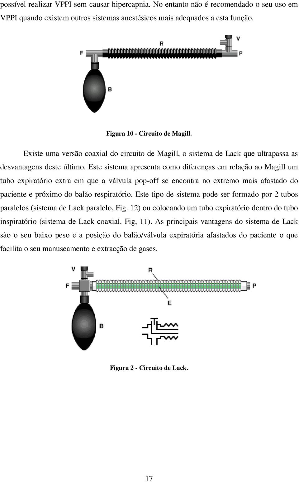 Este sistema apresenta como diferenças em relação ao Magill um tubo expiratório extra em que a válvula pop-off se encontra no extremo mais afastado do paciente e próximo do balão respiratório.