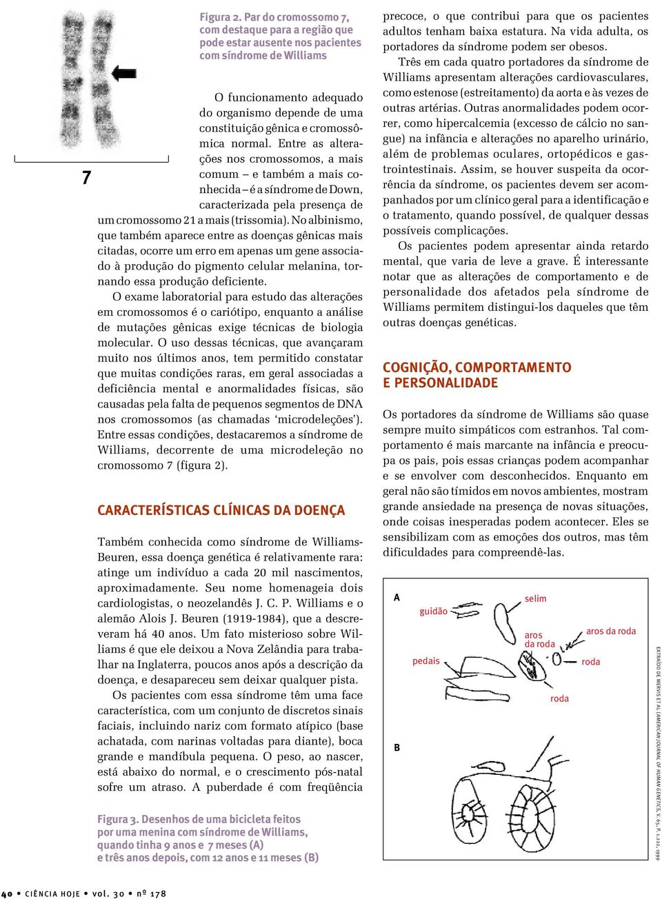 normal. Entre as alterações nos cromossomos, a mais comum e também a mais conhecida é a síndrome de Down, caracterizada pela presença de um cromossomo 21 a mais (trissomia).