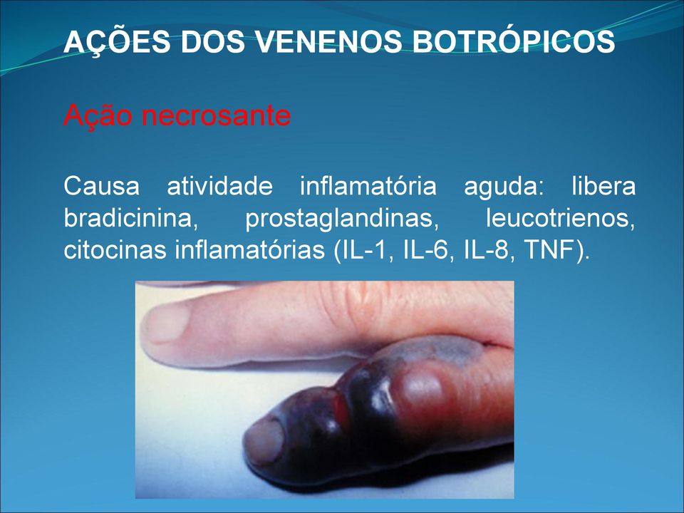 bradicinina, prostaglandinas, leucotrienos,