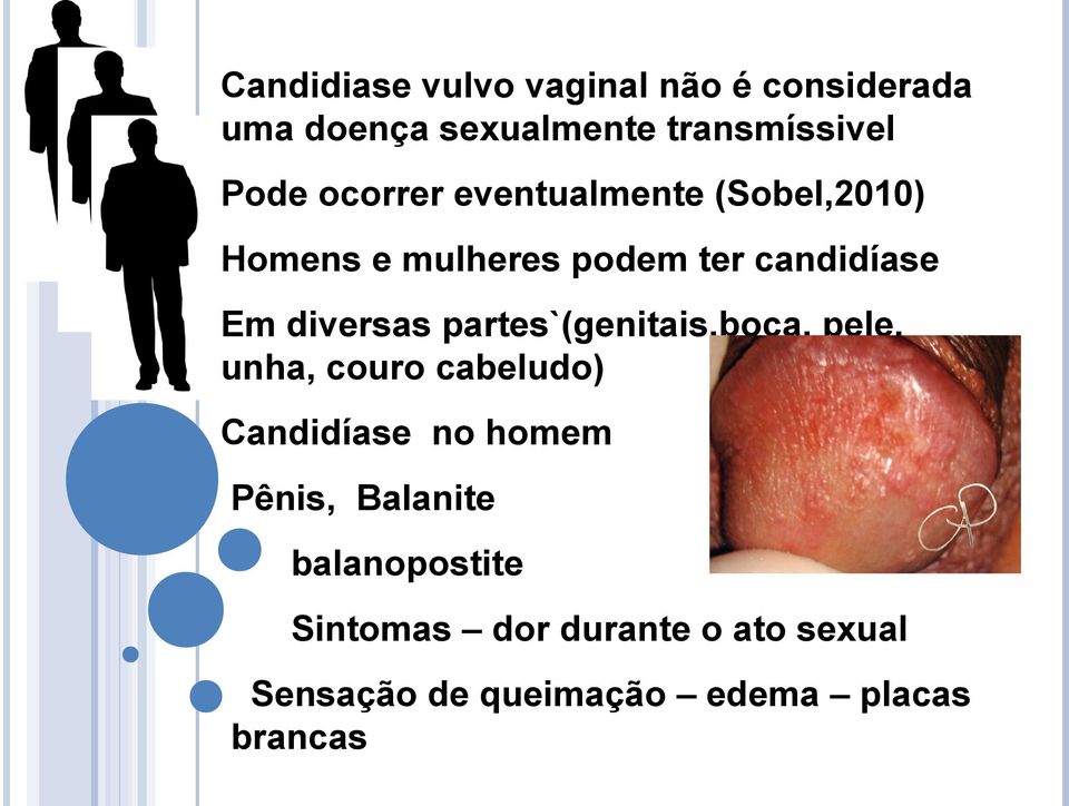 partes`(genitais,boca, pele, unha, couro cabeludo) Candidíase no homem Pênis, Balanite