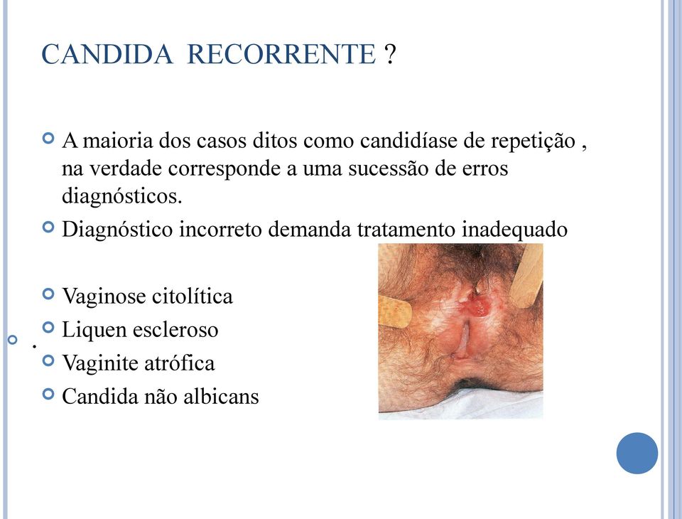 corresponde a uma sucessão de erros diagnósticos.