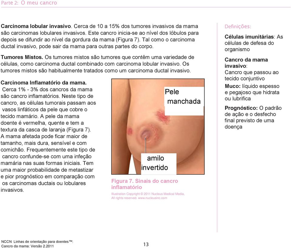 Tumores Mistos. Os tumores mistos são tumores que contêm uma variedade de células, como carcinoma ductal combinado com carcinoma lobular invasivo.