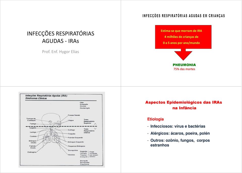 Aspectos Epidemiológicos das IRAs Etiologia na Infância - Infecciosos: vírus e bactérias - Alérgicos: ácaros, poeira, polén -