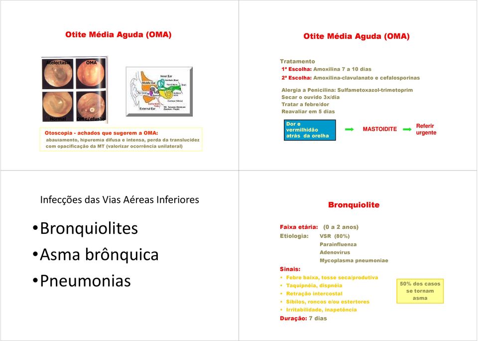 Sulfametoxazol-trimetoprim Secar o ouvido 3x/dia Tratar a febre/dor Reavaliar em 5 dias Dor e vermilhidão atrás da orelha MASTOIDITE Referir urgente Infecções das Vias Aéreas Inferiores Bronquiolites
