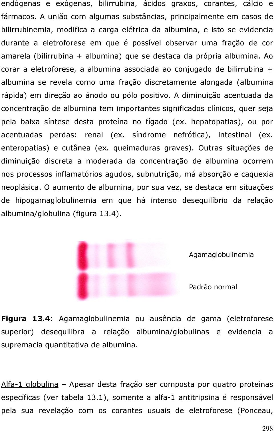 cor amarela (bilirrubina + albumina) que se destaca da própria albumina.
