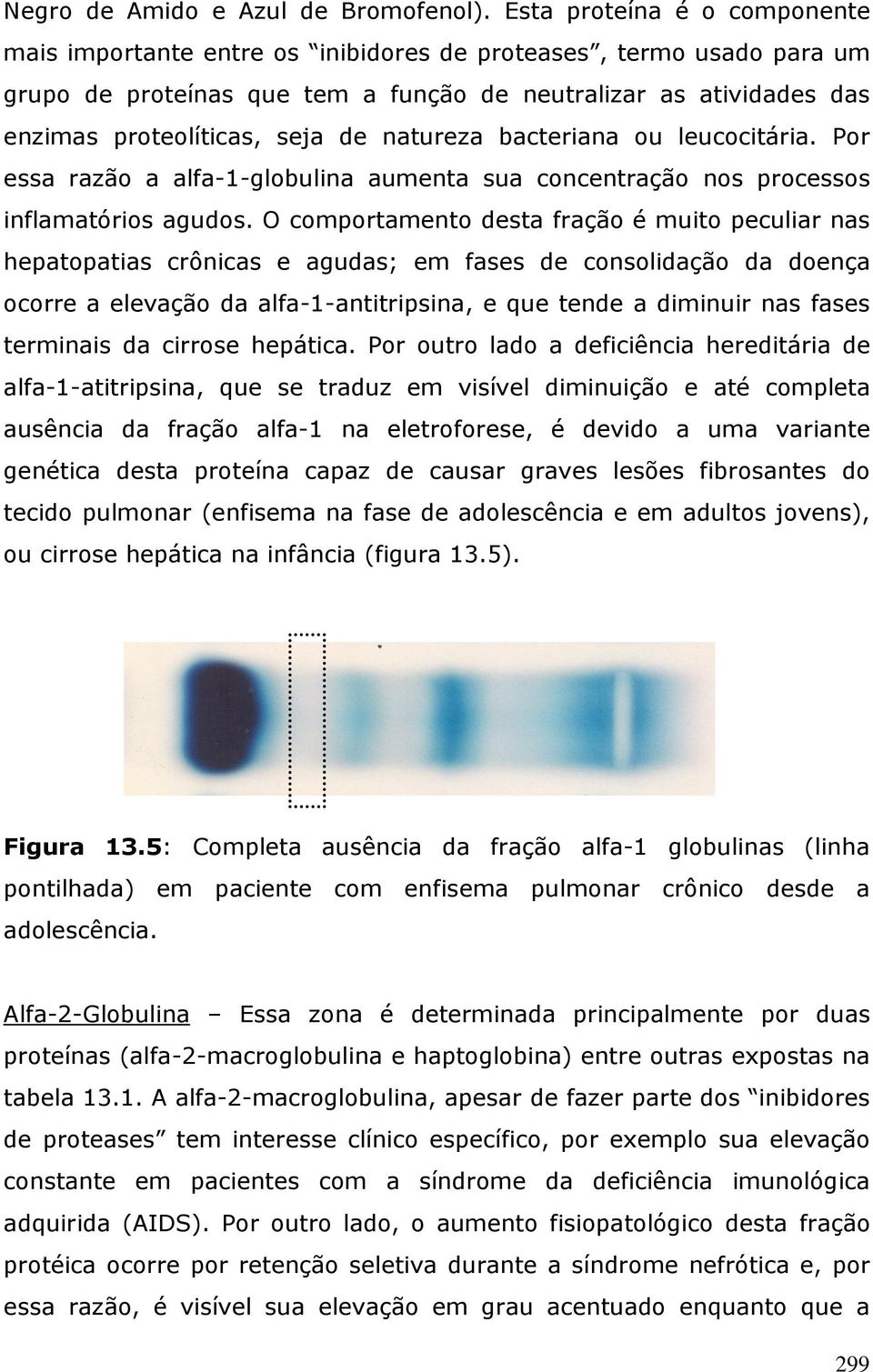 natureza bacteriana ou leucocitária. Por essa razão a alfa-1-globulina aumenta sua concentração nos processos inflamatórios agudos.