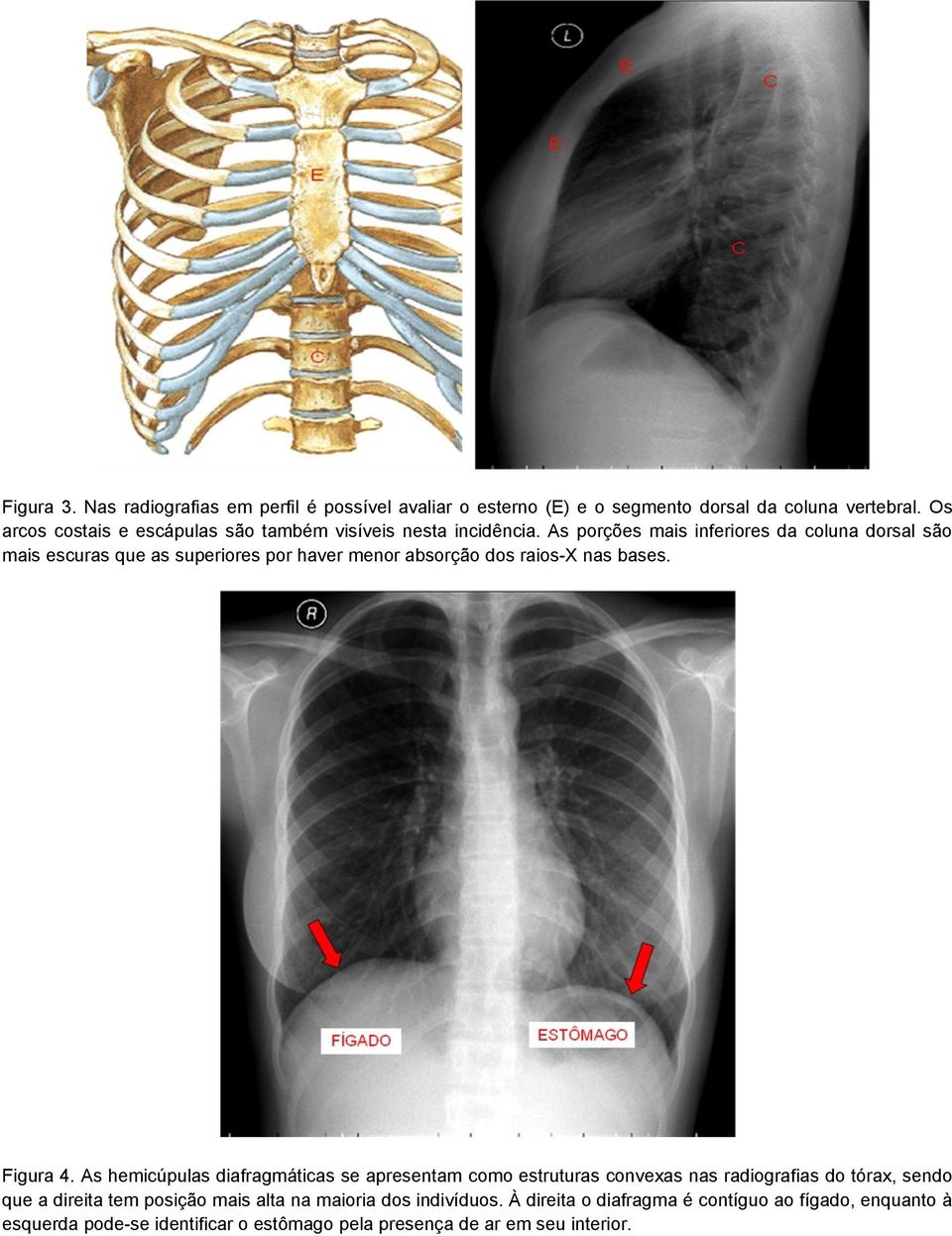 As porções mais inferiores da coluna dorsal são mais escuras que as superiores por haver menor absorção dos raios-x nas bases. Figura 4.