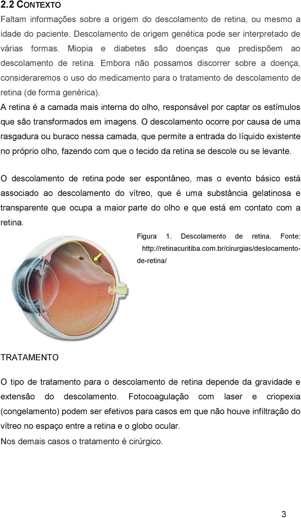 Embora não possamos discorrer sobre a doença, consideraremos o uso do medicamento para o tratamento de descolamento de retina (de forma genérica).