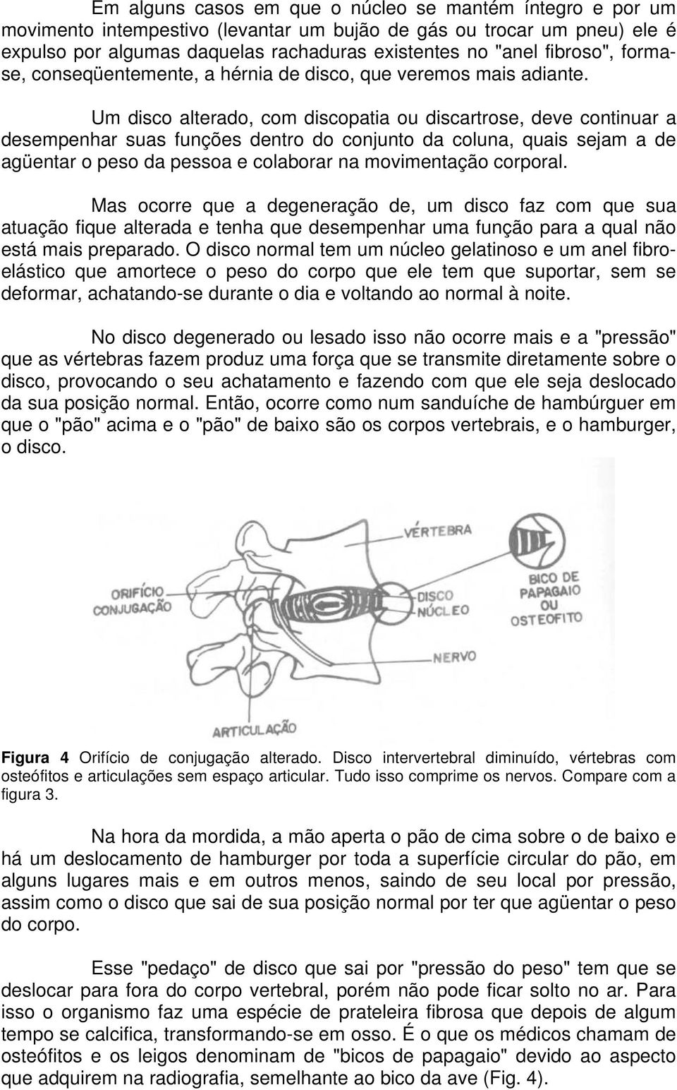 Um disco alterado, com discopatia ou discartrose, deve continuar a desempenhar suas funções dentro do conjunto da coluna, quais sejam a de agüentar o peso da pessoa e colaborar na movimentação