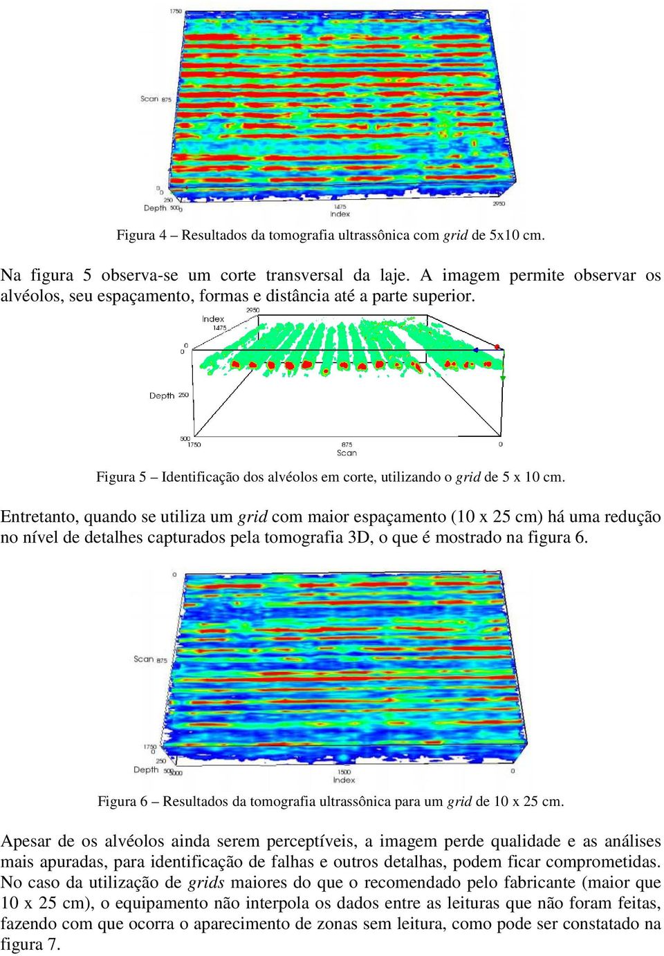 Entretanto, quando se utiliza um grid com maior espaçamento (10 x 25 cm) há uma redução no nível de detalhes capturados pela tomografia 3D, o que é mostrado na figura 6.