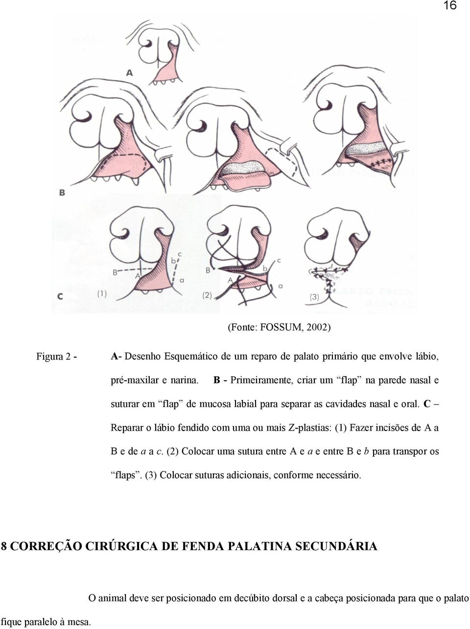 C Reparar o lábio fendido com uma ou mais Z-plastias: (1) Fazer incisões de A a B e de a a c.