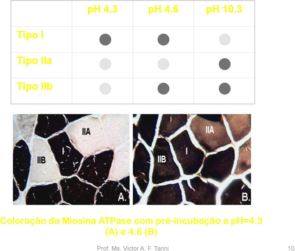 da Miosina ATPase com pré-incubação