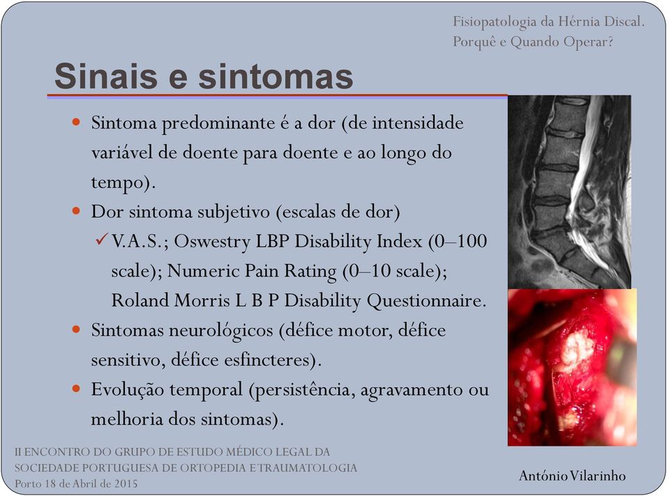 ; Oswestry LBP Disability Index (0 100 scale); Numeric Pain Rating (0 10 scale); Roland Morris L B P Disability