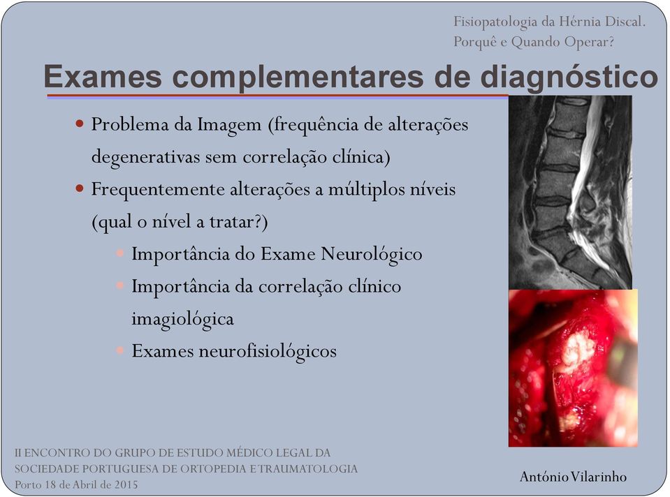 alterações a múltiplos níveis (qual o nível a tratar?