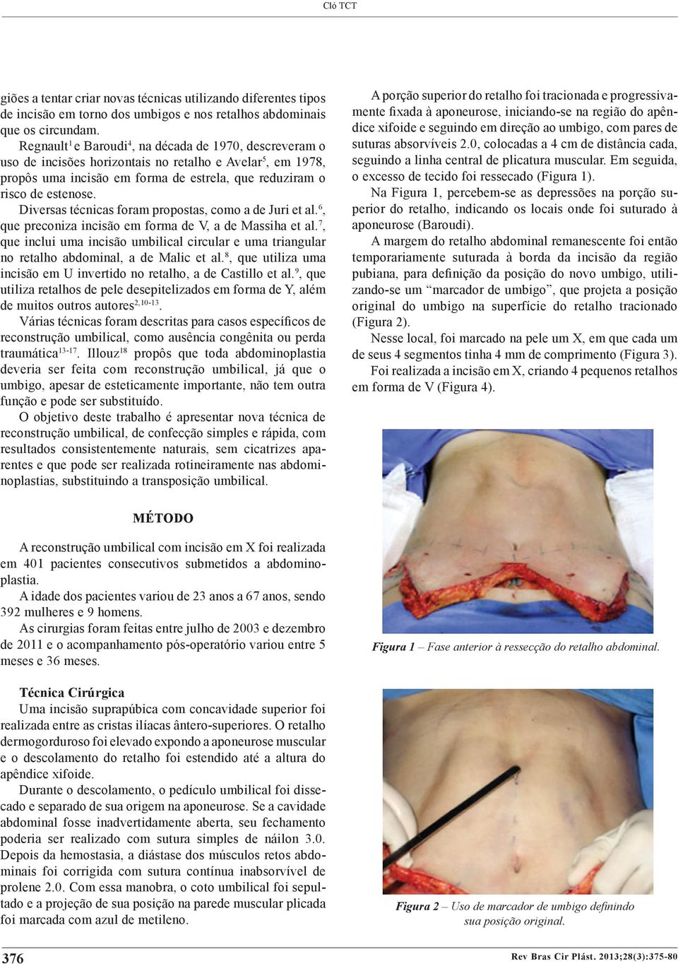 iversas técnicas foram propostas, como a de Juri et al. 6, que preconiza incisão em forma de V, a de Massiha et al.