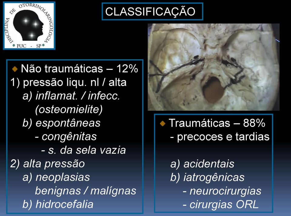 da sela vazia 2) alta pressão a) neoplasias benignas / malígnas b)