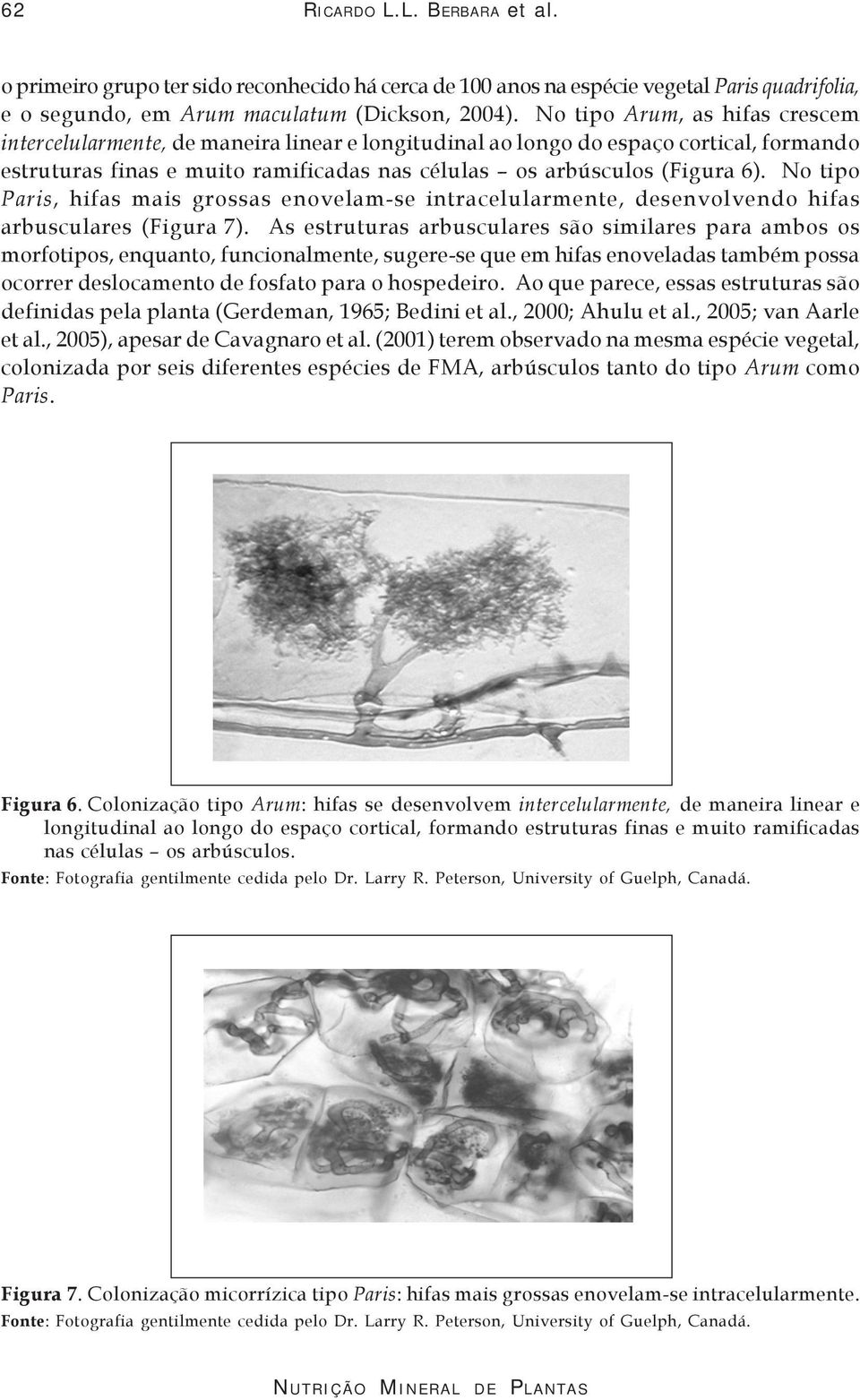 No tipo Paris, hifas mais grossas enovelam-se intracelularmente, desenvolvendo hifas arbusculares (Figura 7).