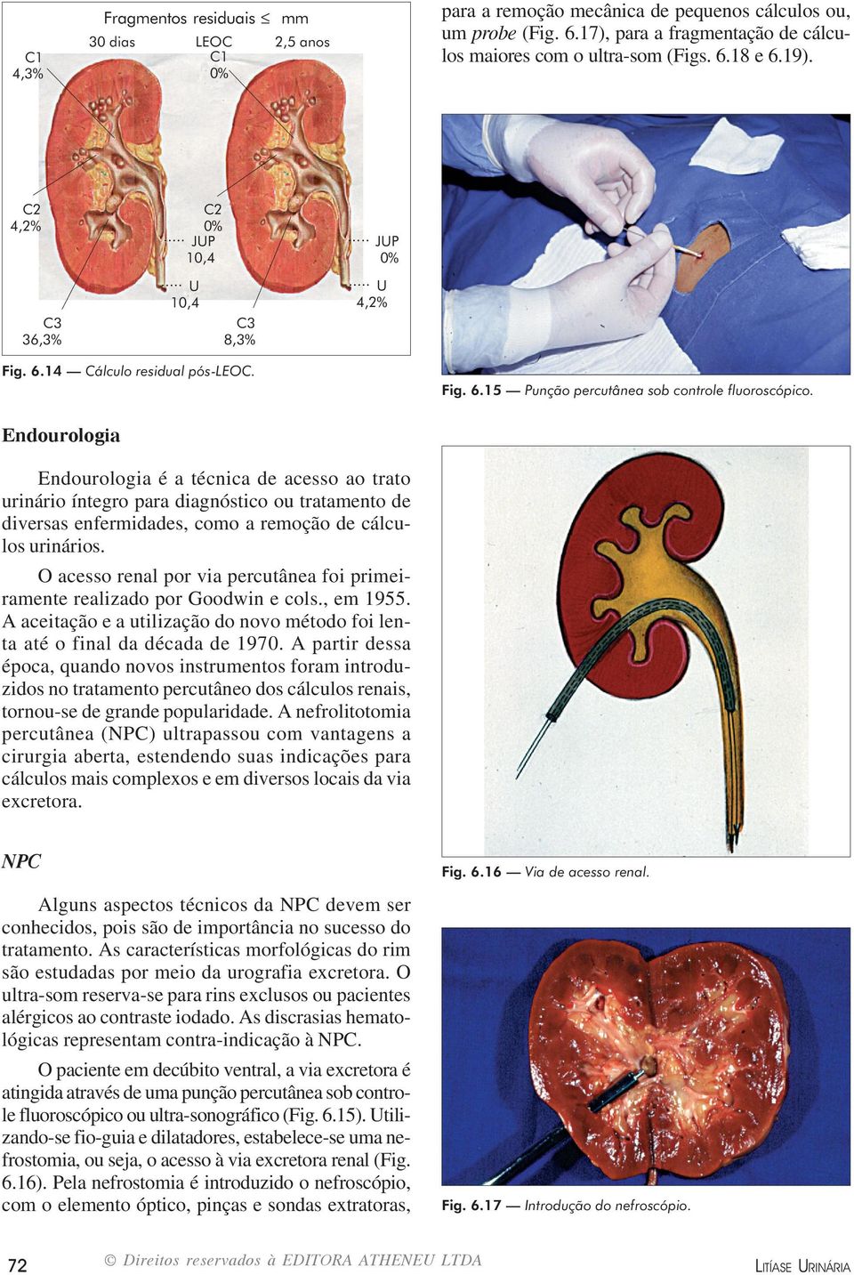 Endourologia Endourologia é a técnica de acesso ao trato urinário íntegro para diagnóstico ou tratamento de diversas enfermidades, como a remoção de cálculos urinários.