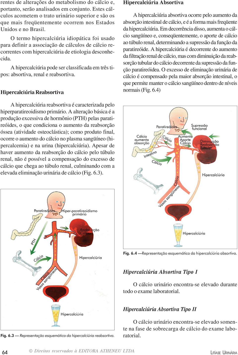 O termo hipercalciúria idiopática foi usado para definir a associação de cálculos de cálcio recorrentes com hipercalciúria de etiologia desconhecida.