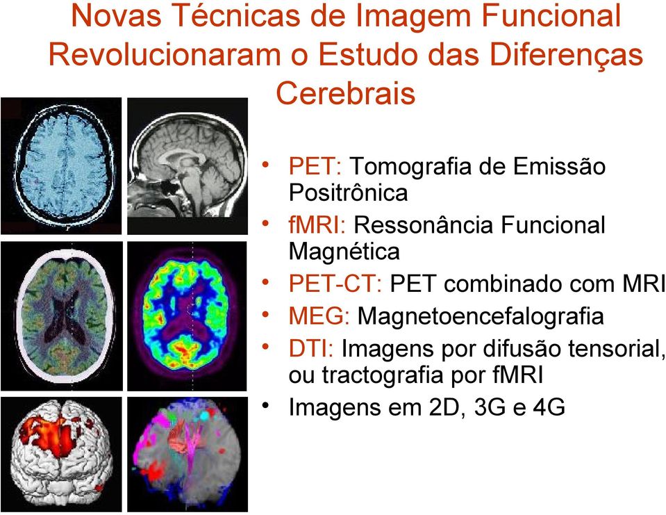 Funcional Magnética PET-CT: PET combinado com MRI MEG: