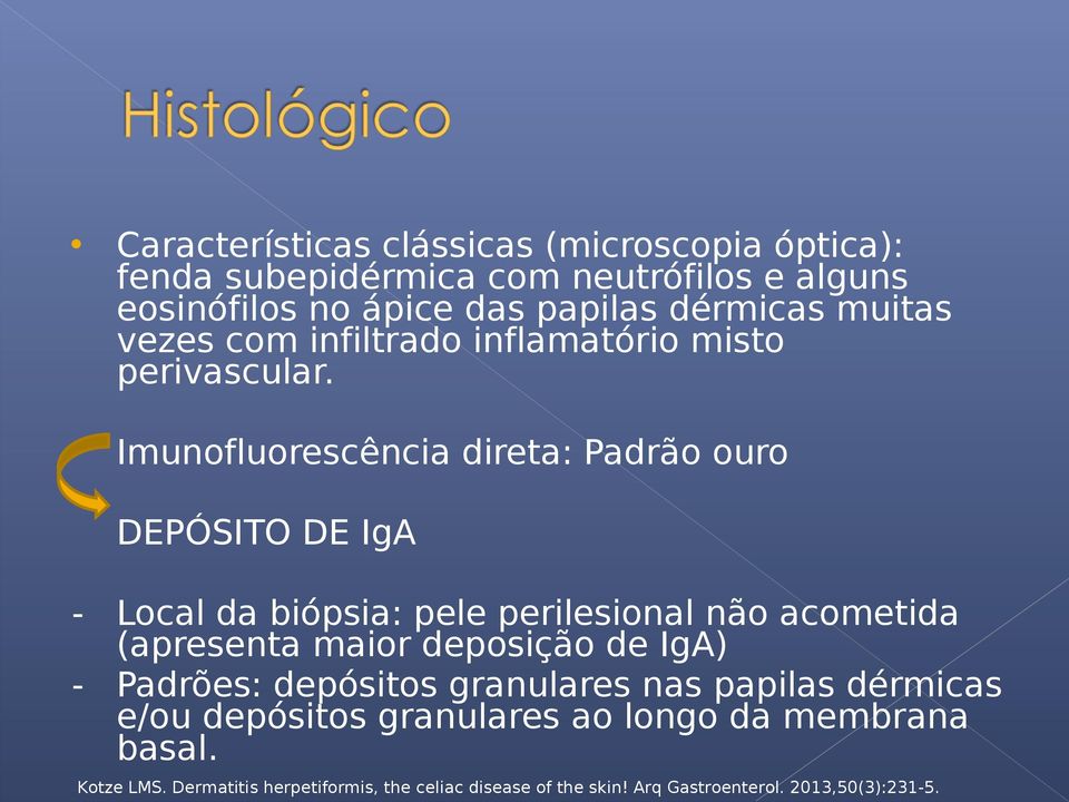 Imunofluorescência direta: Padrão ouro DEPÓSITO DE IgA - Local da biópsia: pele perilesional não acometida