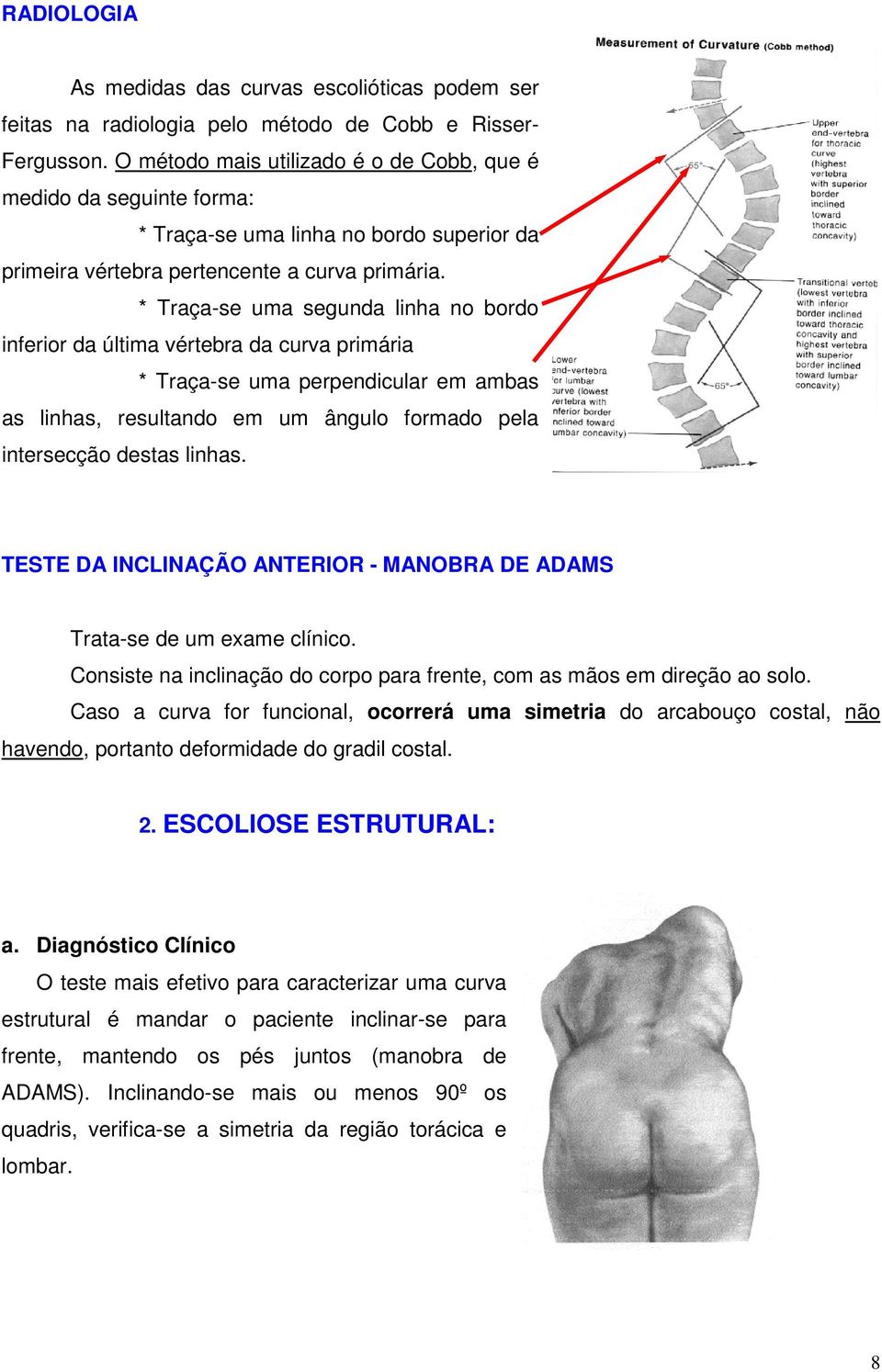 * Traça-se uma segunda linha no bordo inferior da última vértebra da curva primária * Traça-se uma perpendicular em ambas as linhas, resultando em um ângulo formado pela intersecção destas linhas.