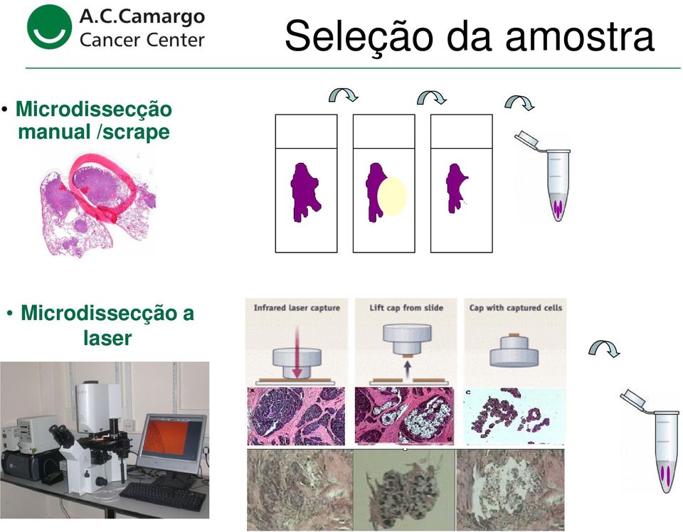 Microdissecção