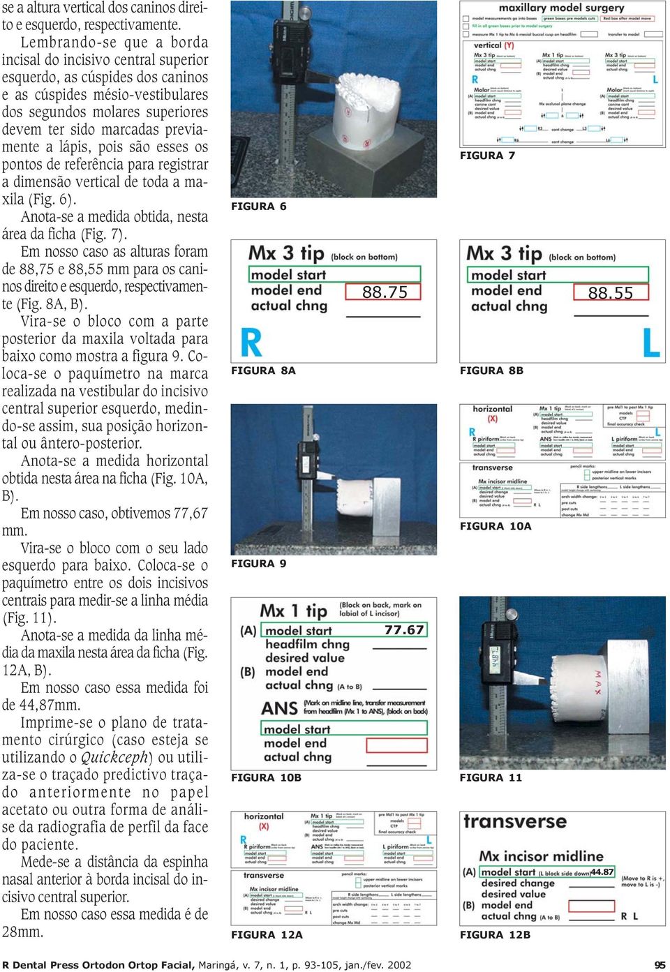 lápis, pois são esses os pontos de referência para registrar a dimensão vertical de toda a maxila (Fig. 6). Anota-se a medida obtida, nesta área da ficha (Fig. 7).