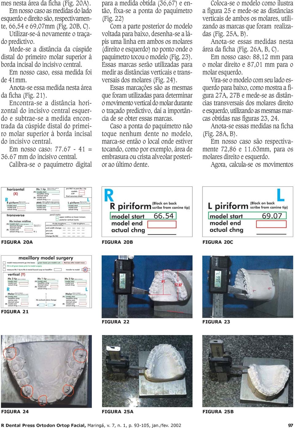 Encontra-se a distância horizontal do incisivo central esquerdo e subtrae-se a medida encontrada da cúspide distal do primeiro molar superior à borda incisal do incisivo central. Em nosso caso: 77.