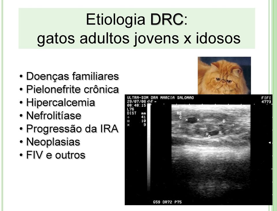 crônica Hipercalcemia Nefrolitíase