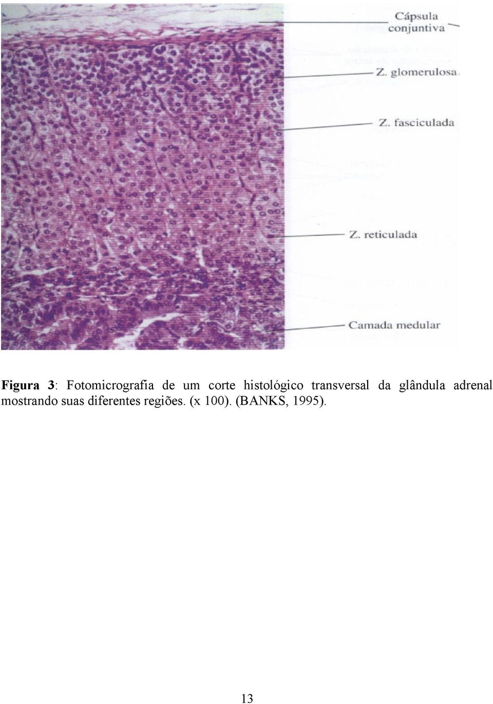 glândula adrenal mostrando suas