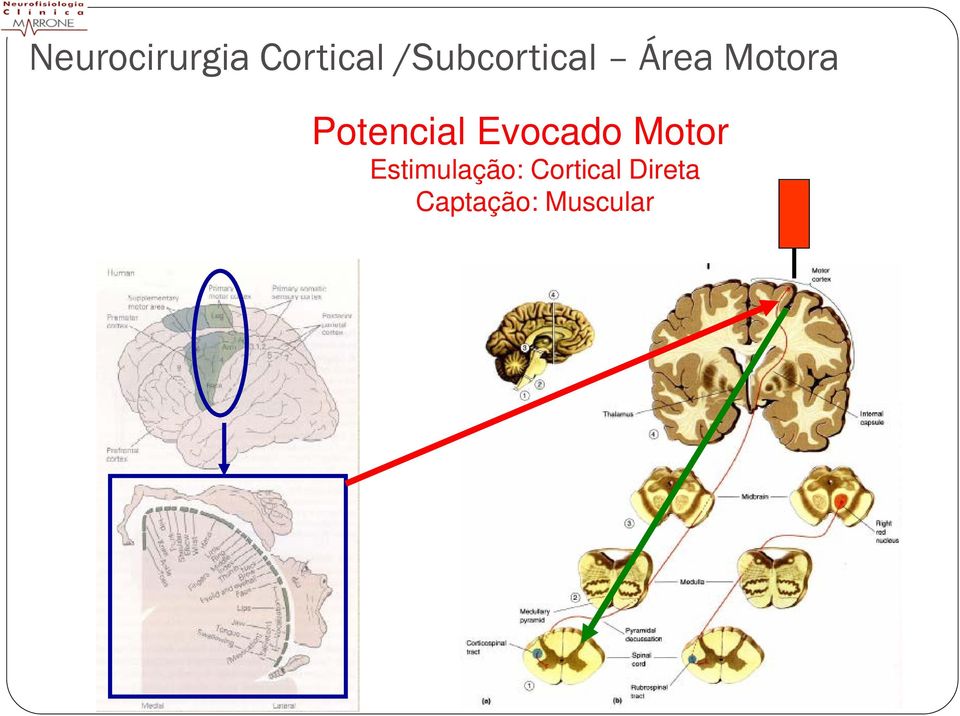 Potencial Evocado Motor