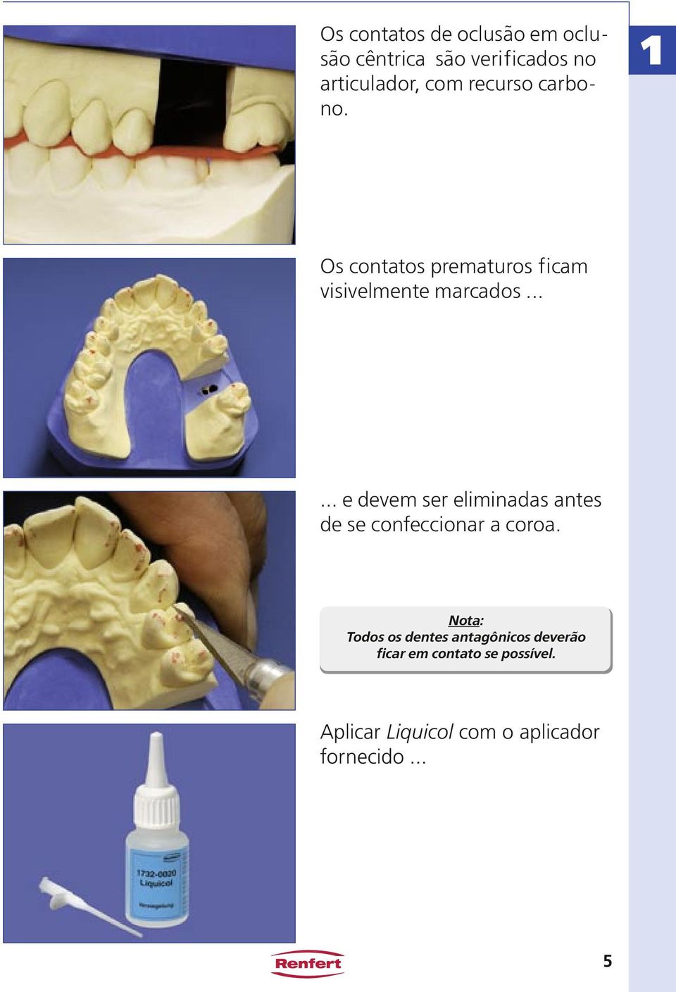 ..... e devem ser eliminadas antes de se confeccionar a coroa.