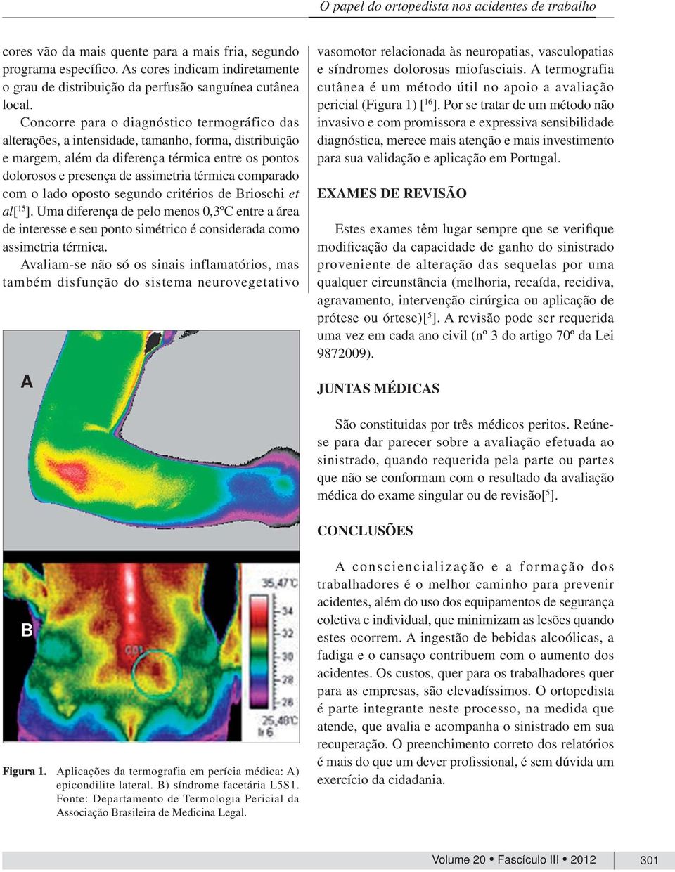 Concorre para o diagnóstico termográfico das alterações, a intensidade, tamanho, forma, distribuição e margem, além da diferença térmica entre os pontos dolorosos e presença de assimetria térmica