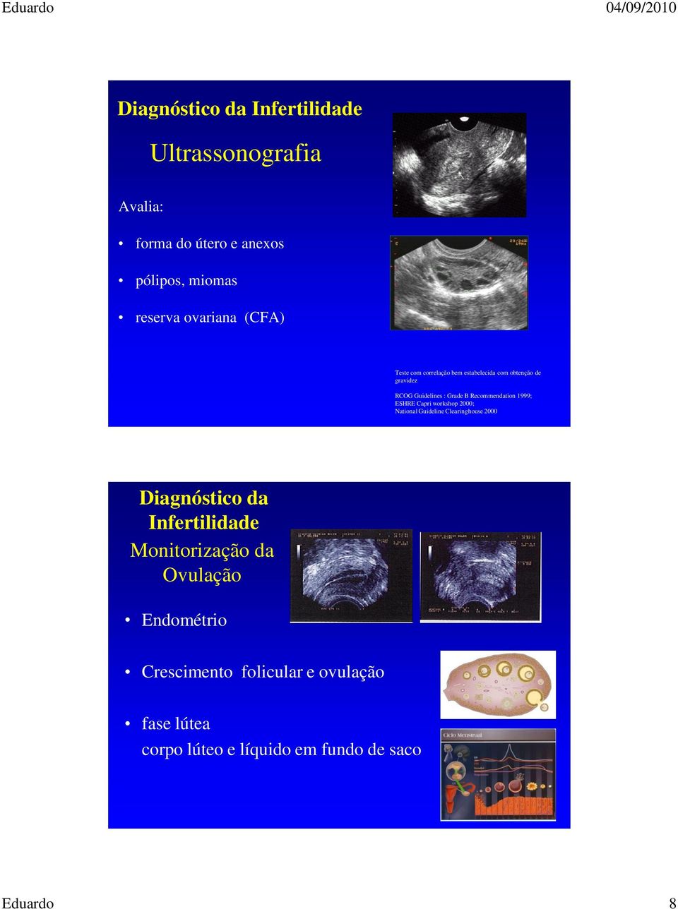 Capri workshop 2000; National Guideline Clearinghouse 2000 Diagnóstico da Infertilidade Monitorização da