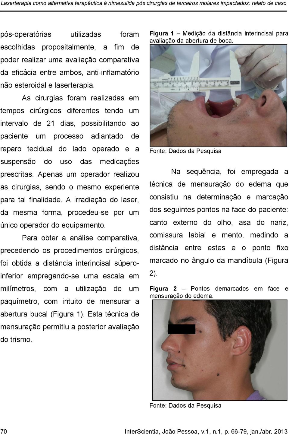 As cirurgias foram realizadas em tempos cirúrgicos diferentes tendo um intervalo de 21 dias, possibilitando ao paciente um processo adiantado de reparo tecidual do lado operado e a suspensão do uso