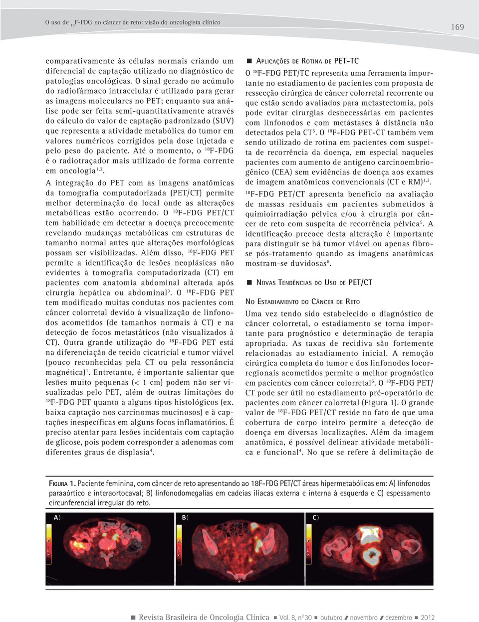 captação padronizado (SUV) que representa a atividade metabólica do tumor em valores numéricos corrigidos pela dose injetada e pelo peso do paciente.