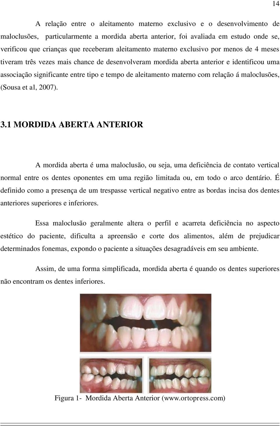 materno com relação á maloclusões, (Sousa et al, 2007). 3.